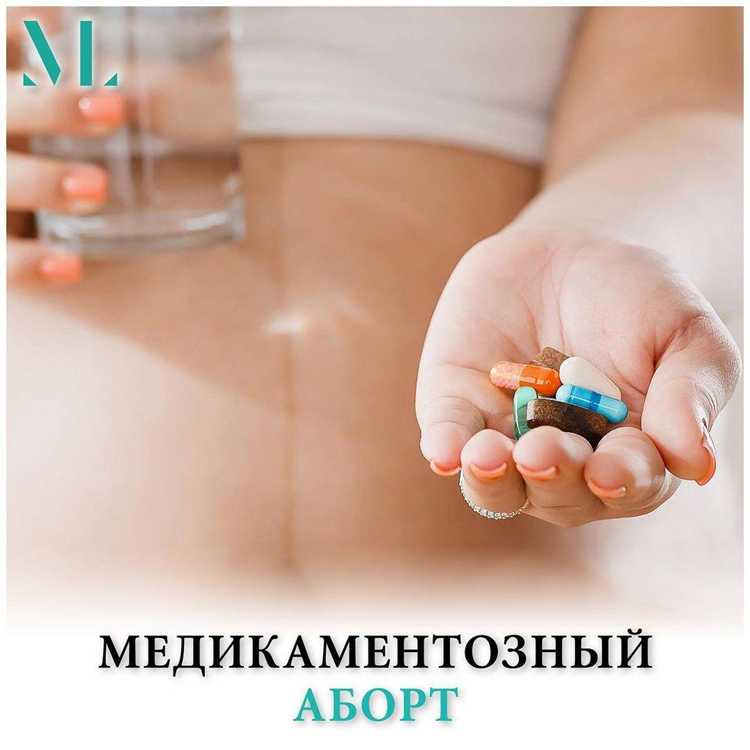 Правовые аспекты медикаментозного аборта в разных странах