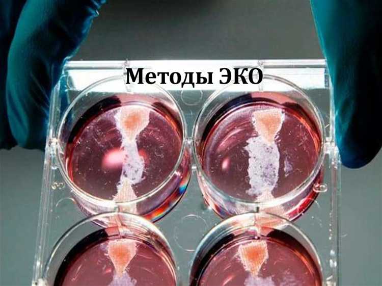 Экологические стандарты и сертификация продукции