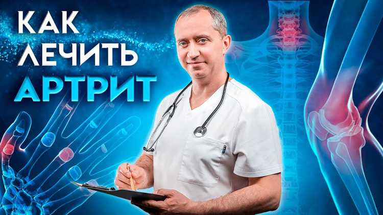 Фармакотерапия: выбор препаратов против артрита
