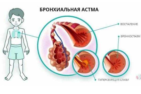 Влияние стрессовых ситуаций на дыхательные функции